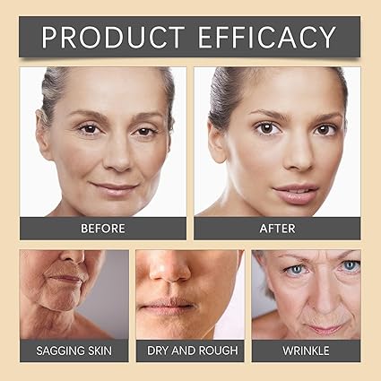 OUHOE Bee Venom Botox Wrinkle Cream – Anti-Aging Moisturizing Face Cream (20g)